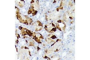 Immunohistochemistry of paraffin-embedded rat kidney using CRYAB Rabbit mAb (ABIN7266528) at dilution of 1:100 (40x lens).