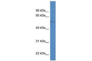 WB Suggested Anti-ZIC1 Antibody Titration:  0. (ZIC1 Antikörper  (N-Term))