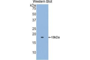 Western blot analysis of the recombinant protein. (Retinol Binding Protein 5 Antikörper  (AA 2-135))