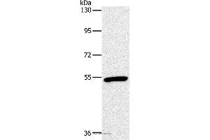 Western blot analysis of Mouse heart tissue, using OXTR Polyclonal Antibody at dilution of 1:866 (Oxytocin Receptor Antikörper)