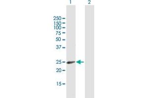 Western Blot analysis of RAB31 expression in transfected 293T cell line by RAB31 MaxPab polyclonal antibody. (RAB31 Antikörper  (AA 1-195))