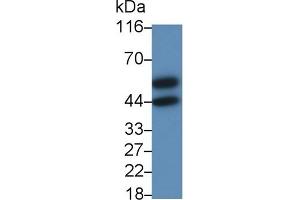 Detection of CSF2Ra in Human Placenta lysate using Polyclonal Antibody to Colony Stimulating Factor 2 Receptor Alpha (CSF2Ra) (CSF2RA Antikörper  (AA 103-264))