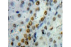 Used in DAB staining on fromalin fixed paraffin-embedded Kidney tissue (HMGB1 Antikörper  (AA 1-215))