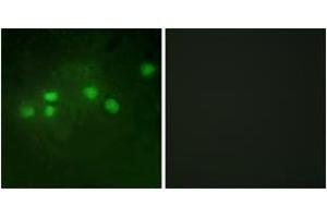 Immunofluorescence analysis of A549 cells, using ELF1 Antibody. (ELF1 Antikörper  (AA 537-586))