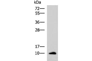 Western blot analysis of Human ileum tissue lysate using CCL13 Polyclonal Antibody at dilution of 1:700 (CCL13 Antikörper)