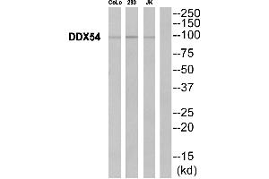 Western blot analysis of extracts from CoLo cells, 293 cells and JurKat cells, using DDX54 antibody. (DDX54 Antikörper  (Internal Region))