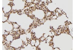 ABIN6269273 at 1/100 staining Rat lung tissue by IHC-P.