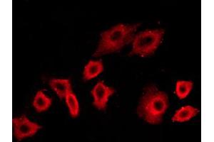ABIN6267453 staining NIH/3T3 cells by ICC/IF.