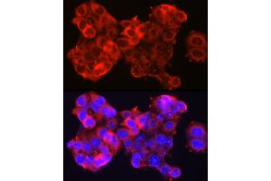 Immunofluorescence analysis of HepG2 cells using SSC/SerpinB3 Rabbit pAb (ABIN6131348, ABIN6147587, ABIN6147588 and ABIN6221070) at dilution of 1:100 (40x lens). (SERPINB3 Antikörper  (AA 1-230))