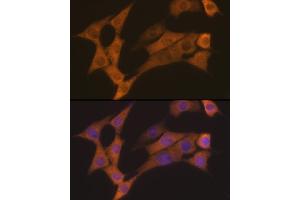 Immunofluorescence analysis of NIH-3T3 cells using Cyclin B2 Rabbit mAb (ABIN7266557) at dilution of 1:100 (40x lens). (Cyclin B2 Antikörper)