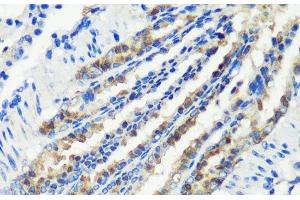 Immunohistochemistry (Paraffin-embedded Sections) (IHC (p)) image for anti-Myeloid/lymphoid Or Mixed-Lineage Leukemia 5 (Trithorax Homolog) (MLL5) antibody (ABIN7261988)