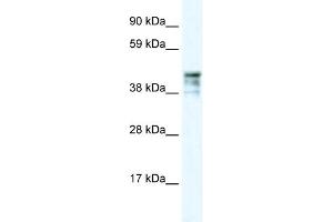 WB Suggested Anti-KRT15 Antibody Titration: 0. (KRT15 Antikörper  (C-Term))