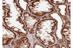 ABIN6278956 at 1/100 staining Human kidney tissue by IHC-P. (WNT7B Antikörper  (C-Term))