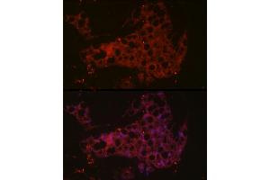 Immunofluorescence analysis of mouse brown adipose cells using UCP1 Rabbit pAb (ABIN6128899, ABIN6149883, ABIN6149885 and ABIN6221561) at dilution of 1:50 (40x lens). (UCP1 Antikörper  (AA 1-307))