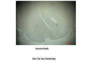 Immunohistochemistry (IHC) analysis: Please contact us for more details. (TH Antikörper  (Tyr161))