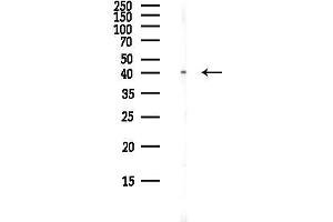 Western blot analysis of lysates from EC304 cells(LPS, 4h treatment), using CCR3 Antibody at 1/1000 dilution.