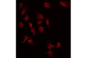 ABIN6275219 staining Hela by IF/ICC. (MASP2 Antikörper  (Internal Region))
