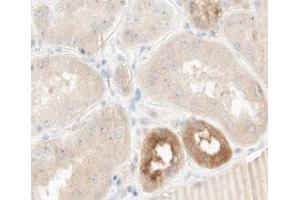 ABIN6266916 at 1/100 staining human kidney tissue sections by IHC-P. (TNFAIP2 Antikörper)