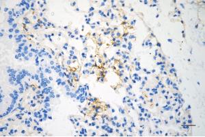 Immunohistochemistry was performed on paraffin-embedded mouse lung using caveolin 1 antibody (ABIN7797944), 1:200). (Rekombinanter Caveolin-1 Antikörper)