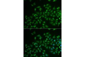Immunofluorescence analysis of U2OS cell using MPP2 antibody. (MPP2 Antikörper)