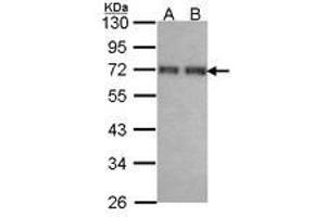Image no. 2 for anti-Coiled-Coil Domain Containing 6 (CCDC6) (AA 1-232) antibody (ABIN467500)