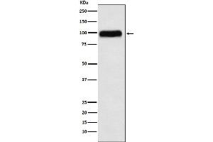 Western blot analysis of SERPING1 expression in Human plasma lysate.
