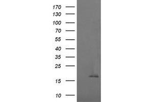 Image no. 1 for anti-Cancer/testis Antigen 1B (CTAG1B) antibody (ABIN1499901) (CTAG1B Antikörper)