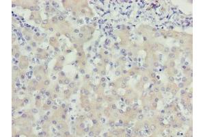 Immunohistochemistry of paraffin-embedded human liver tissue using ABIN7175806 at dilution of 1:100