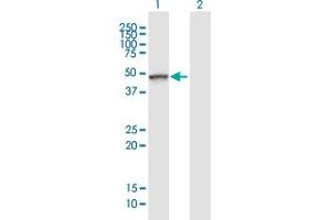Western Blot analysis of TLE6 expression in transfected 293T cell line ( H00079816-T01 ) by TLE6 MaxPab polyclonal antibody. (TLE6 Antikörper  (AA 1-449))