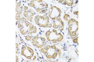 Immunohistochemistry of paraffin-embedded human stomach using B9D1 antibody. (B9D1 Antikörper  (AA 1-130))