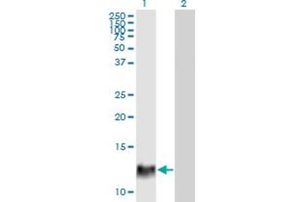 HBXIP anticorps  (AA 83-173)