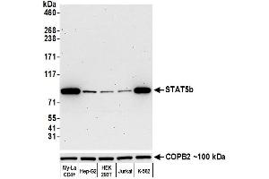 Western Blotting (WB) image for anti-Signal Transducer and Activator of Transcription 5B (STAT5B) (AA 737-787) antibody (ABIN7455110) (Rekombinanter STAT5B Antikörper  (AA 737-787))