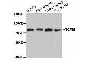 Western blot analysis of extracts of various cell lines, using TGFBI antibody (ABIN5971386) at 1/1000 dilution. (TGFBI Antikörper)
