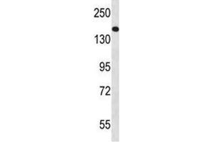Western Blotting (WB) image for anti-Niemann-Pick Disease, Type C1 (NPC1) (AA 591-620) antibody (ABIN3031998)