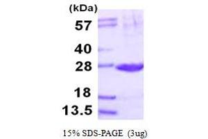 SDS-PAGE (SDS) image for Proteasome (Prosome, Macropain) Subunit, beta Type 2 (PSMB2) (AA 1-201) protein (His tag) (ABIN667624)