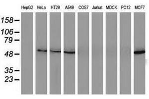 Image no. 2 for anti-Sequestosome 1 (SQSTM1) antibody (ABIN1499991)