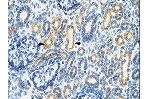 Image no. 1 for anti-Interferon Regulatory Factor 8 (IRF8) (AA 35-84) antibody (ABIN202494) (IRF8 Antikörper  (AA 35-84))