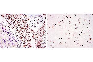 Immunohistochemistry (IHC) image for anti-Protein Kinase, DNA-Activated, Catalytic Polypeptide (PRKDC) antibody (ABIN969366)