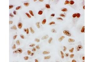 Immunocytochemistry (ICC) image for anti-Splicing Factor 1 (SF1) (N-Term) antibody (ABIN3032719)