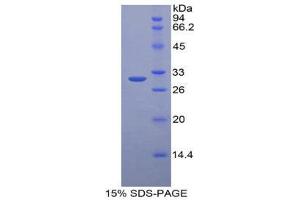 SDS-PAGE (SDS) image for Homogentisate 1,2-Dioxygenase (HGD) (AA 190-429) protein (His tag) (ABIN2125219)