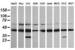 Image no. 1 for anti-Mitogen-Activated Protein Kinase Kinase 1 (MAP2K1) antibody (ABIN1499395) (MEK1 Antikörper)