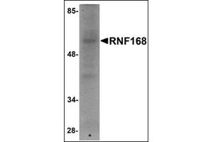 Western blot analysis of RNF168 in human brain tissue lysate with this product at 1 μg/ml.