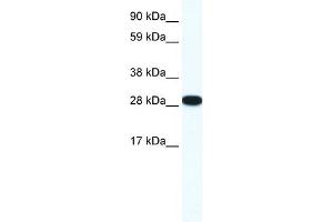 WB Suggested Anti-ZFP36L1 Antibody Titration: 0. (ZFP36L1 Antikörper  (N-Term))