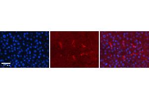 Rabbit Anti-CDK2 Antibody Catalog Number: ARP30331_P050 Formalin Fixed Paraffin Embedded Tissue: Human Liver Tissue Observed Staining: Cytoplasm in Kupffer cells Primary Antibody Concentration: 1:100 Other Working Concentrations: N/A Secondary Antibody: Donkey anti-Rabbit-Cy3 Secondary Antibody Concentration: 1:200 Magnification: 20X Exposure Time: 0.