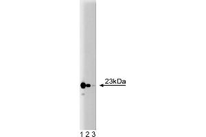 Western Blotting (WB) image for anti-Translocase of Inner Mitochondrial Membrane 23 Homolog (Yeast) (TIMM23) (AA 5-126) antibody (ABIN968428) (TIMM23 Antikörper  (AA 5-126))