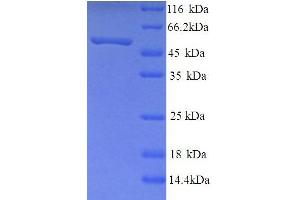 SDS-PAGE (SDS) image for Neuropeptide FF Receptor 2 (NPFF2) (AA 1-420), (full length) protein (His tag) (ABIN5713706)