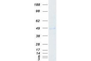 Western Blotting (WB) image for Abhydrolase Domain Containing 2 (ABHD2) (Transcript Variant 1) protein (Myc-DYKDDDDK Tag) (ABIN2714276)