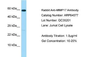 Western Blotting (WB) image for anti-Matrix Metallopeptidase 17 (Membrane-inserted) (MMP17) (C-Term) antibody (ABIN2789884) (MMP17 Antikörper  (C-Term))