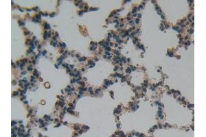 IHC-P analysis of Rat Lung Tissue, with DAB staining. (LIFR Antikörper  (AA 642-791))