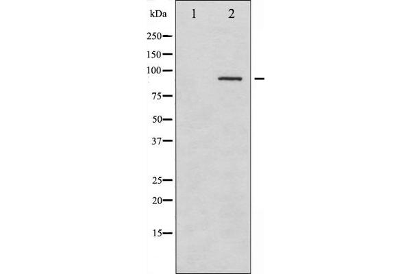SYK antibody  (pTyr323)